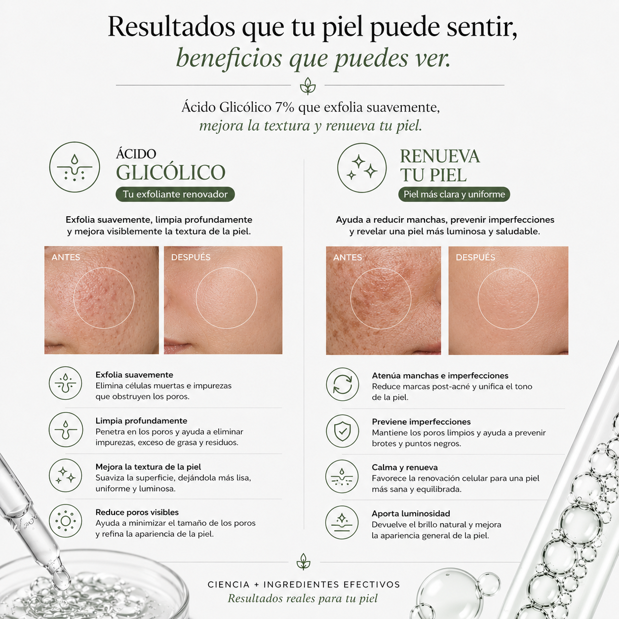 ÁCIDO GLICOLICO  7%