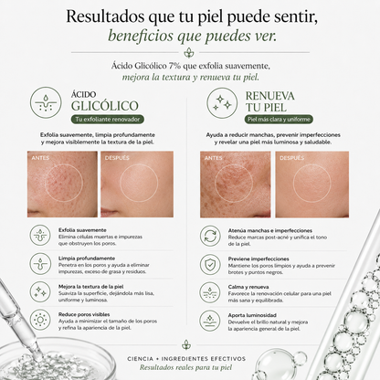 ÁCIDO GLICOLICO  7%