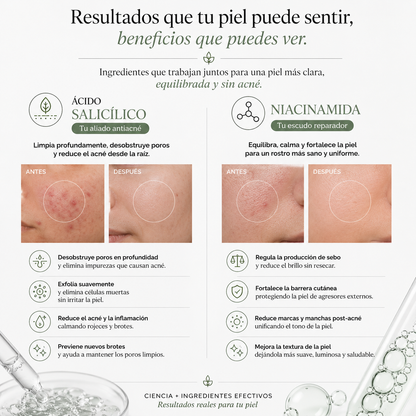 COMBO NIACINAMIDA + ÁCIDO SALICÍLICO